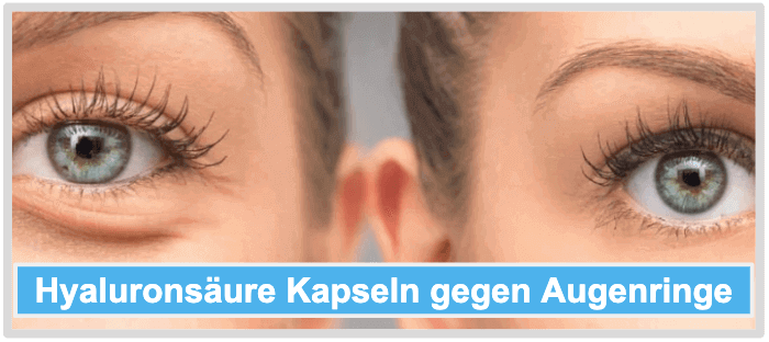 Hyaluronsäure Kapseln Augenringe Anwendungsgebiete